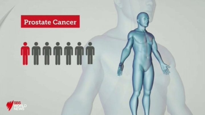 Sbsod Prostate Cancer Blogs Treatment – ISMRQA